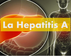 Hepatitis A (hav)